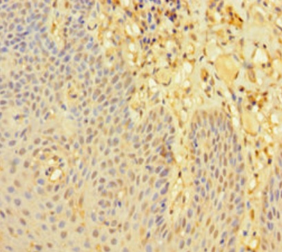 Immunohistochemistry (Formalin/PFA-fixed paraffin-embedded sections) - Anti-LMO2 antibody (AB222847)