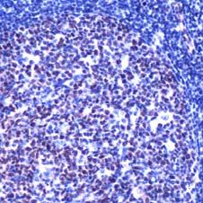 Immunohistochemistry (Formalin/PFA-fixed paraffin-embedded sections) - Anti-LMO2 antibody (AB70633)