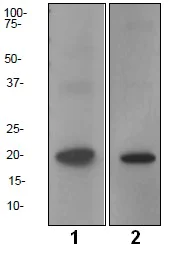 Western blot - Anti-LMO2 antibody [EP3257] (AB91652)