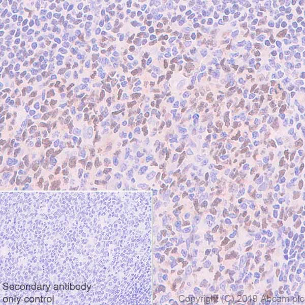 Immunohistochemistry (Formalin/PFA-fixed paraffin-embedded sections) - Anti-LMO2 antibody [EPR22404-45] (AB245250)