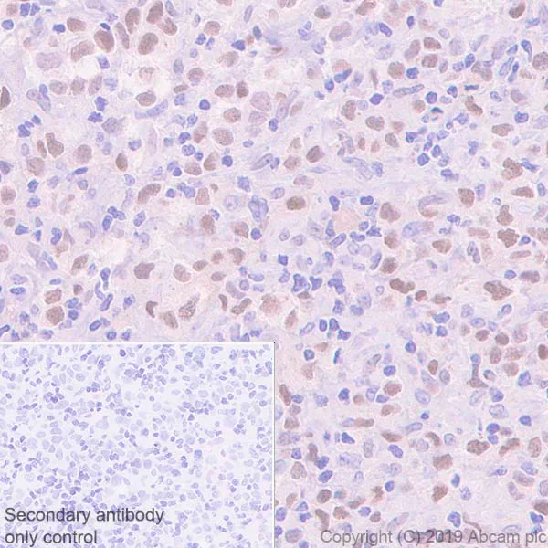 Immunohistochemistry (Formalin/PFA-fixed paraffin-embedded sections) - Anti-LMO2 antibody [EPR22404-45] (AB245250)