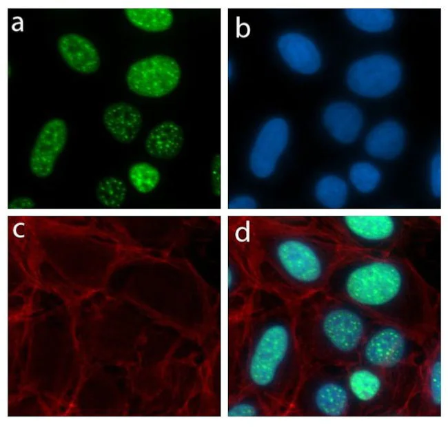 Immunocytochemistry/ Immunofluorescence - Anti-LMO2 antibody [RP23040039] (AB308022)