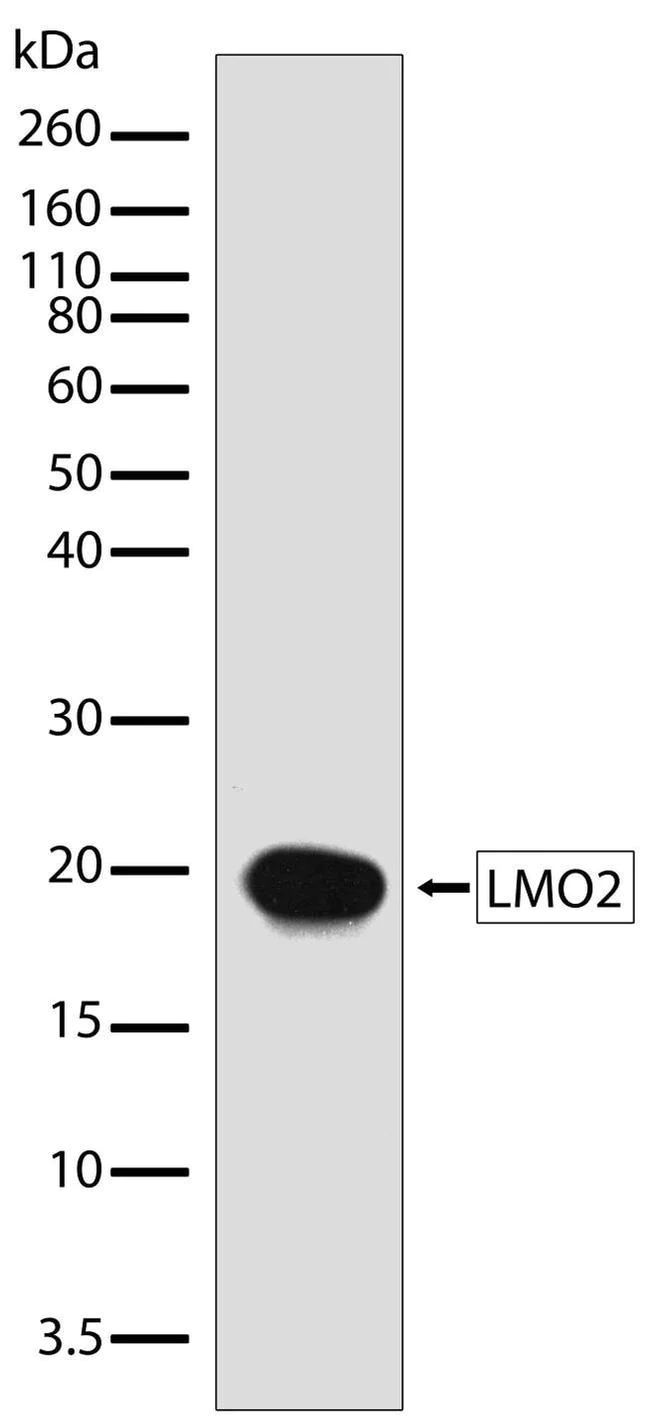 Western blot - Anti-LMO2 antibody [RP23040039] (AB308022)
