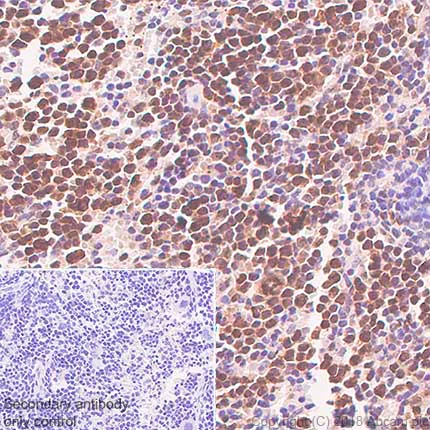 Immunohistochemistry (Formalin/PFA-fixed paraffin-embedded sections) - Anti-LMO2 antibody [SP51] - BSA and Azide free (AB240267)
