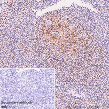 Immunohistochemistry (Formalin/PFA-fixed paraffin-embedded sections) - Anti-LMO2 antibody [SP51] - BSA and Azide free (AB240267)