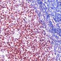 Immunohistochemistry (Formalin/PFA-fixed paraffin-embedded sections) - Anti-LMO2 antibody [SP51] - N-terminal (AB183328)