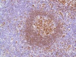 Immunohistochemistry (Formalin/PFA-fixed paraffin-embedded sections) - Anti-LMO2 antibody [SP51] - N-terminal (AB183328)
