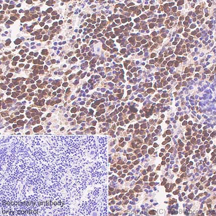 Anti-LMO2 antibody [SP51] - N-terminal