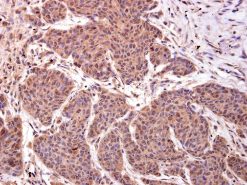 Immunohistochemistry (Formalin/PFA-fixed paraffin-embedded sections) - Anti-LMO4 antibody (AB229226)