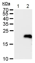 Western blot - Anti-LMO4 antibody (AB229226)