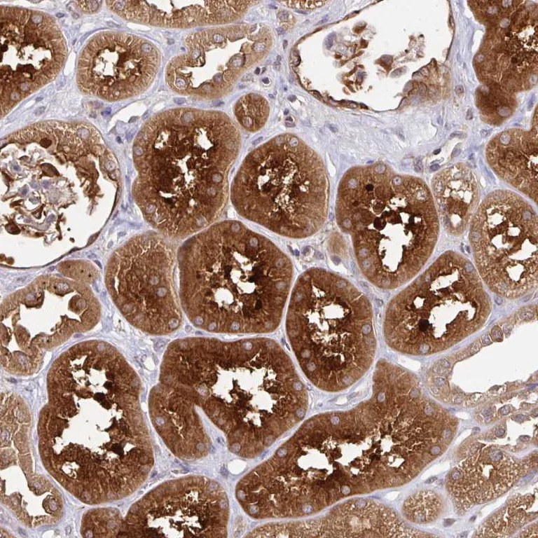 Immunohistochemistry (Formalin/PFA-fixed paraffin-embedded sections) - Anti-LMO4 antibody (AB251966)