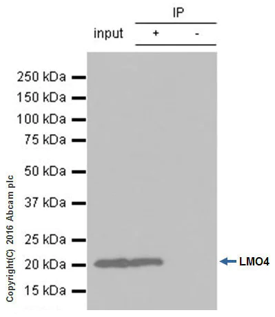 Immunoprecipitation - Anti-LMO4 antibody [EPR6731(2)] - BSA and Azide free (AB248352)