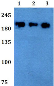 Western blot - Anti-LMO7 antibody (AB200675)