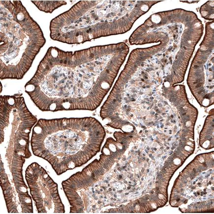 Immunohistochemistry (Formalin/PFA-fixed paraffin-embedded sections) - Anti-LMO7 antibody (AB224113)