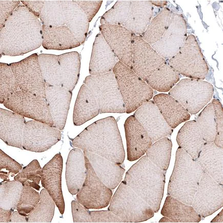 Immunohistochemistry (Formalin/PFA-fixed paraffin-embedded sections) - Anti-LMO7 antibody (AB224113)