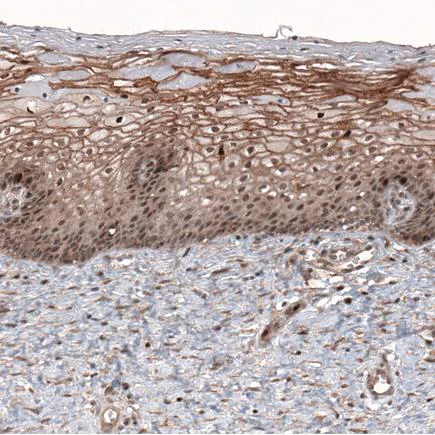 Immunohistochemistry (Formalin/PFA-fixed paraffin-embedded sections) - Anti-LMO7 antibody (AB224113)