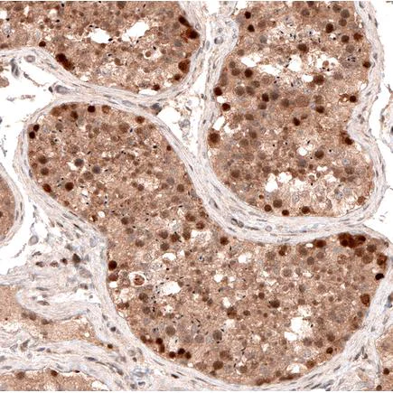 Immunohistochemistry (Formalin/PFA-fixed paraffin-embedded sections) - Anti-LMO7 antibody (AB224113)