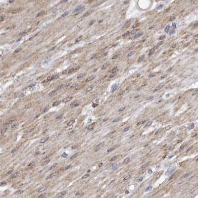 Immunohistochemistry (Formalin/PFA-fixed paraffin-embedded sections) - Anti-LMOD1 antibody (AB244415)