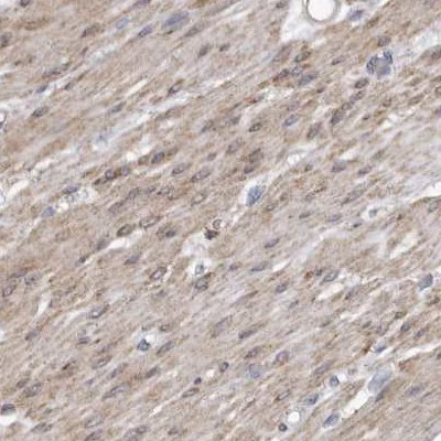 Immunohistochemistry (Formalin/PFA-fixed paraffin-embedded sections) - Anti-LMOD1 antibody (AB244415)