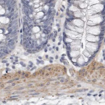 Immunohistochemistry (Formalin/PFA-fixed paraffin-embedded sections) - Anti-LMOD1 antibody (AB244415)