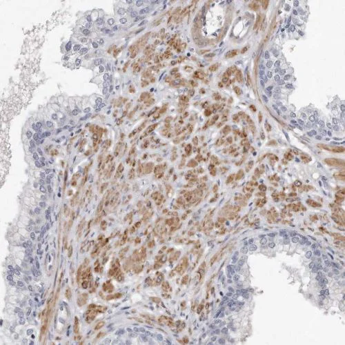 Immunohistochemistry (Formalin/PFA-fixed paraffin-embedded sections) - Anti-LMOD1 antibody (AB244415)