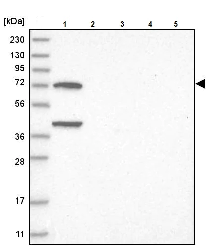 Western blot - Anti-LMOD1 antibody (AB244415)