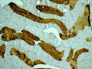 Immunohistochemistry (Formalin/PFA-fixed paraffin-embedded sections) - Anti-LMTK2 antibody [EPR7836(2)] (AB172622)