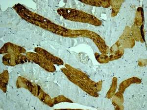 Immunohistochemistry (Formalin/PFA-fixed paraffin-embedded sections) - Anti-LMTK2 antibody [EPR7836(2)] - BSA and Azide free (AB249715)