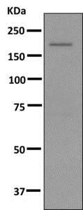 Western blot - Anti-LMTK2 antibody [EPR7836(2)] - BSA and Azide free (AB249715)