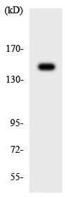 Western blot - Anti-LMTK3 antibody (AB137260)