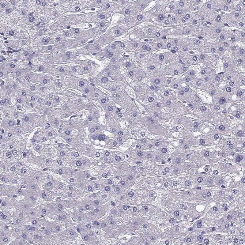 Immunohistochemistry (Formalin/PFA-fixed paraffin-embedded sections) - Anti-LMTK3 antibody (AB262938)