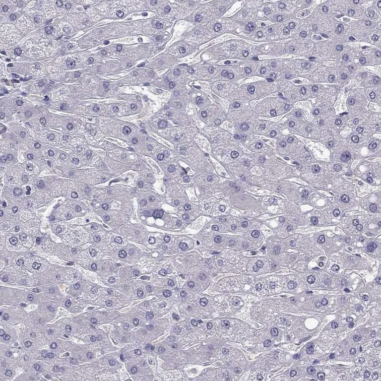 Immunohistochemistry (Formalin/PFA-fixed paraffin-embedded sections) - Anti-LMTK3 antibody (AB262938)