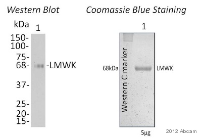 Western blot - Anti-LMW Kininogen antibody (AB79650), expandable thumbnail