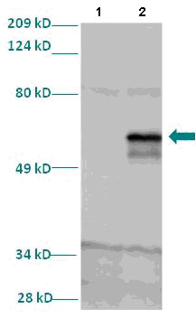 Western blot - Anti-LMX1A antibody (AB82833)
