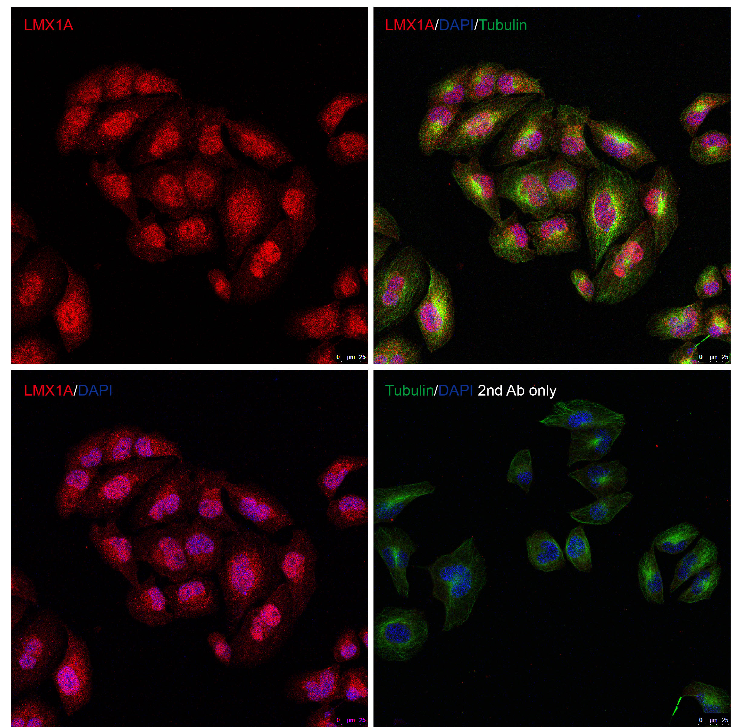 Immunocytochemistry/ Immunofluorescence - Anti-LMX1A antibody - C-terminal (AB139726)