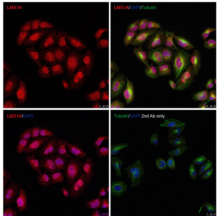 Immunocytochemistry/ Immunofluorescence - Anti-LMX1A antibody - C-terminal (AB139726)
