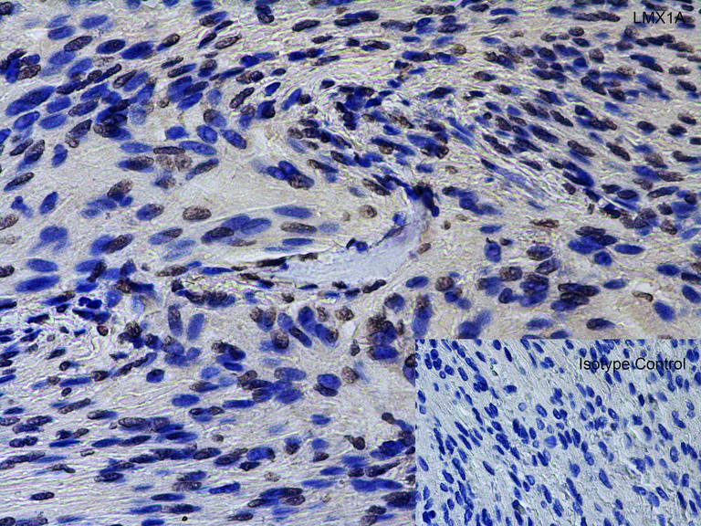 Immunohistochemistry (Formalin/PFA-fixed paraffin-embedded sections) - Anti-LMX1A antibody - C-terminal (AB139726)