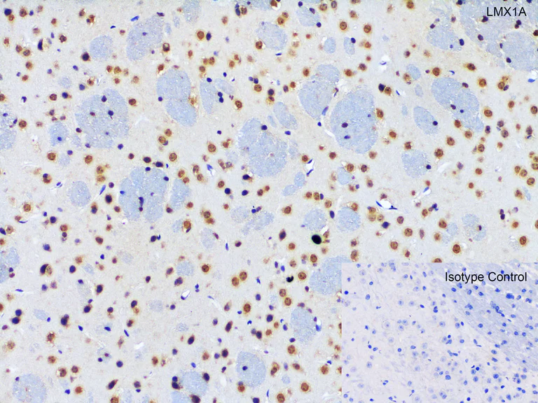 Immunohistochemistry (Formalin/PFA-fixed paraffin-embedded sections) - Anti-LMX1A antibody - C-terminal (AB139726)