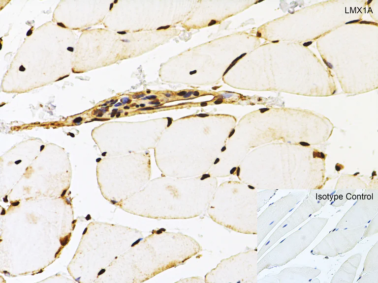 Immunohistochemistry (Formalin/PFA-fixed paraffin-embedded sections) - Anti-LMX1A antibody - C-terminal (AB139726)