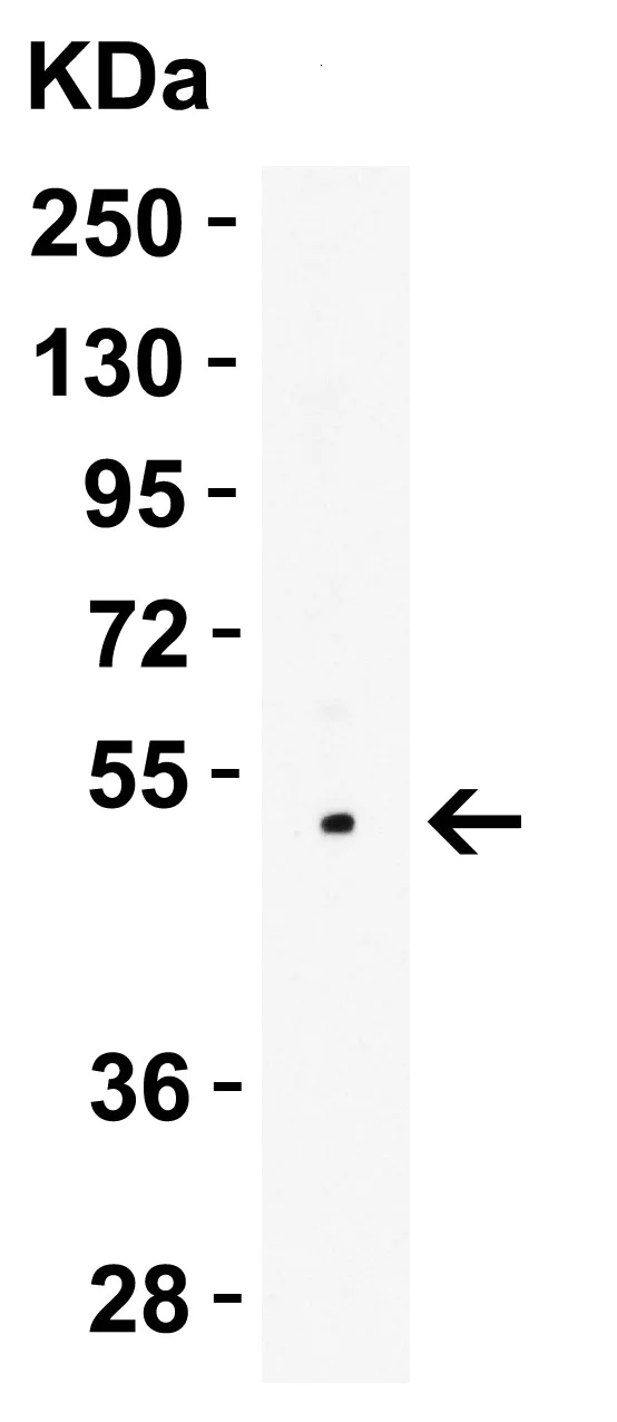 Western blot - Anti-LMX1A antibody - C-terminal (AB139726)