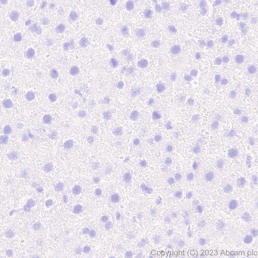 Immunohistochemistry (Formalin/PFA-fixed paraffin-embedded sections) - Anti-LMX1A antibody [EPR27269-57] (AB309538)
