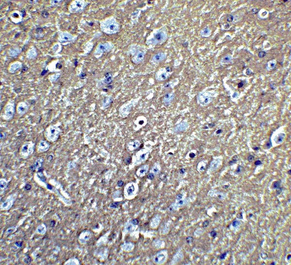 Immunohistochemistry (Formalin/PFA-fixed paraffin-embedded sections) - Anti-LMX1b antibody (AB139736)