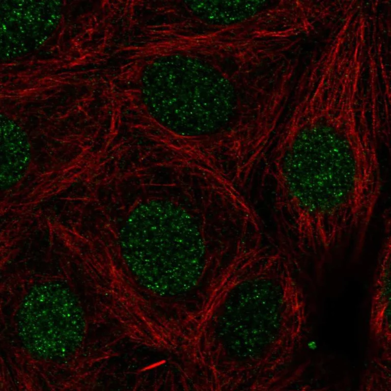 Immunocytochemistry/ Immunofluorescence - Anti-LMX1b antibody (AB272683)