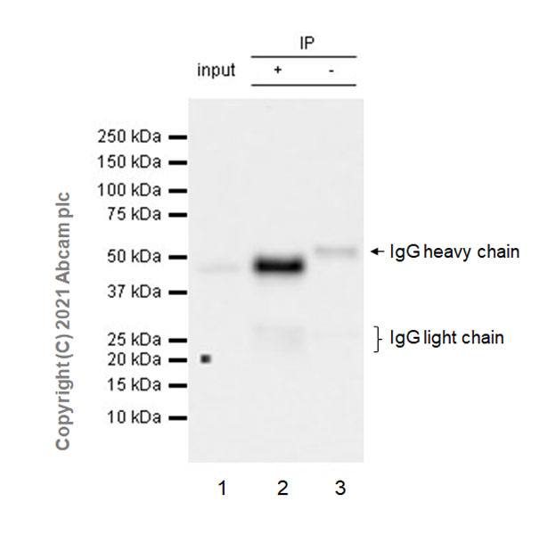 Immunoprecipitation - Anti-LMX1b antibody [EPR24053-161] (ab259926), expandable thumbnail