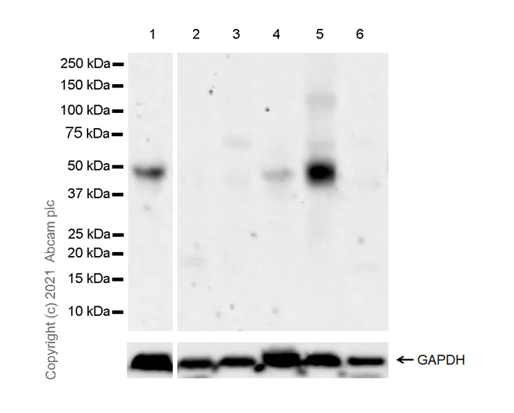 Western blot - Anti-LMX1b antibody [EPR24053-161] - BSA and Azide free (AB281937)