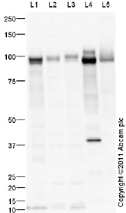Western blot - LNCaP nuclear extract lysate (AB14857)