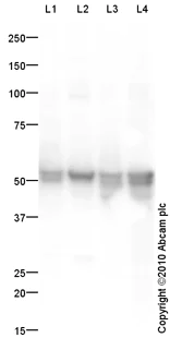 Western blot - LNCaP nuclear extract lysate (AB14857)