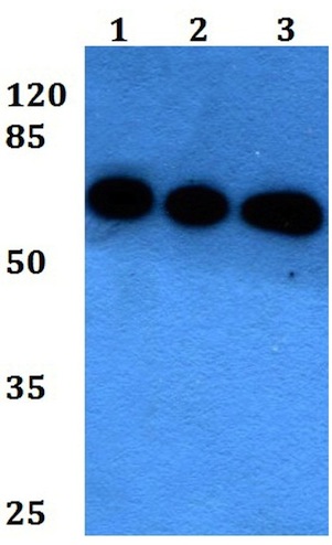 Western blot - Anti-LNK antibody (AB191904)