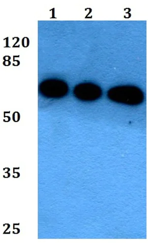 Western blot - Anti-LNK antibody (AB191904)