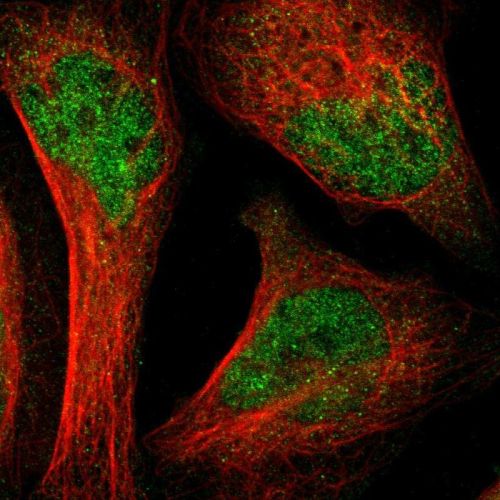 Immunocytochemistry/ Immunofluorescence - Anti-LNK antibody (AB244278)
